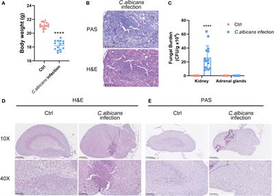 Single-cell atlas of murine adrenal glands reveals immune-adrenal crosstalk during systemic Candida albicans infection